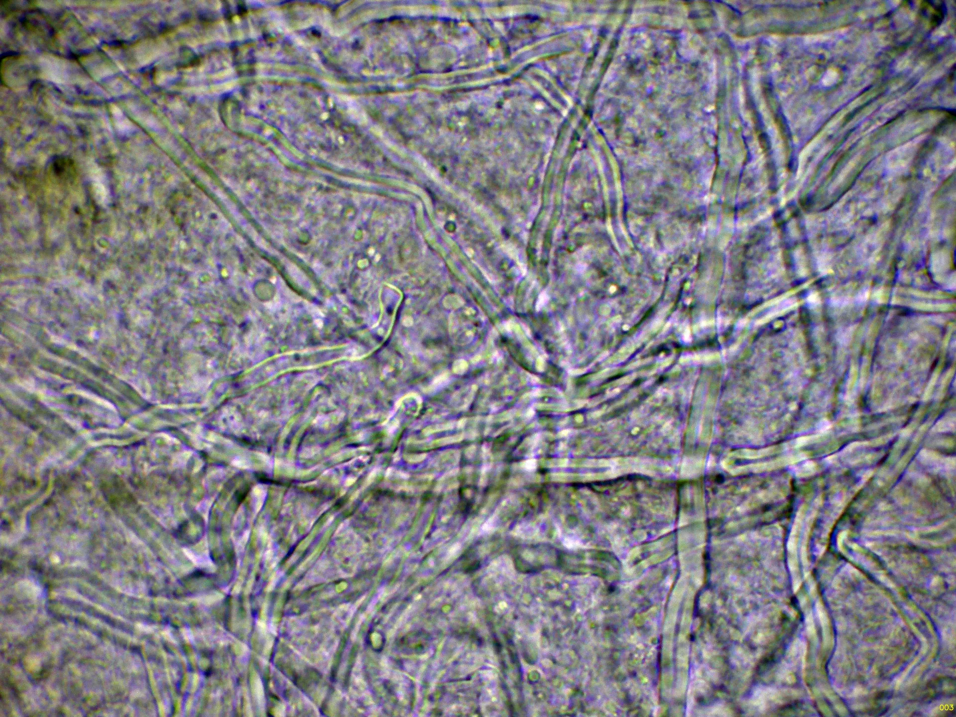 Microscopía de Resinoporia cretacea - 10 - Hifas Melzer-003